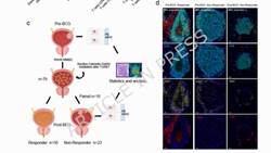 Memory B cells in mature follicle-like tertiary lymphoid structures predict BCG response in non-muscle-invasive bladder cancer